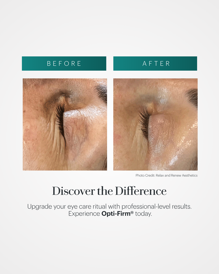 Opti-Firm® Eye Contour Cream